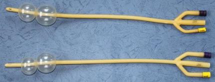 Three-way catheters are catheters that end in three separate prongs, generally used to treat bladder infections.