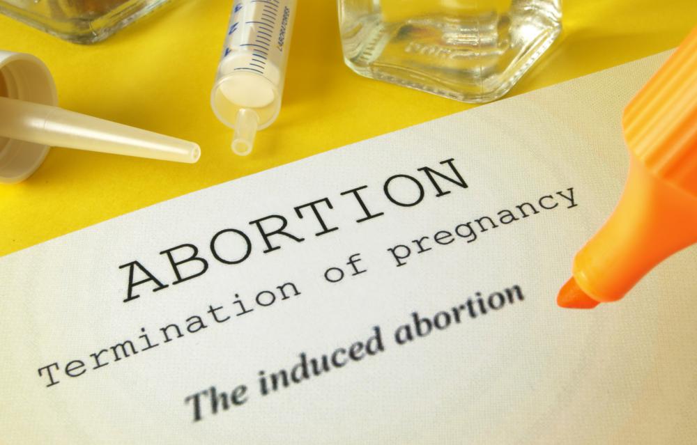 Abortion is perhaps the most hotly debated ethical issue in society today.