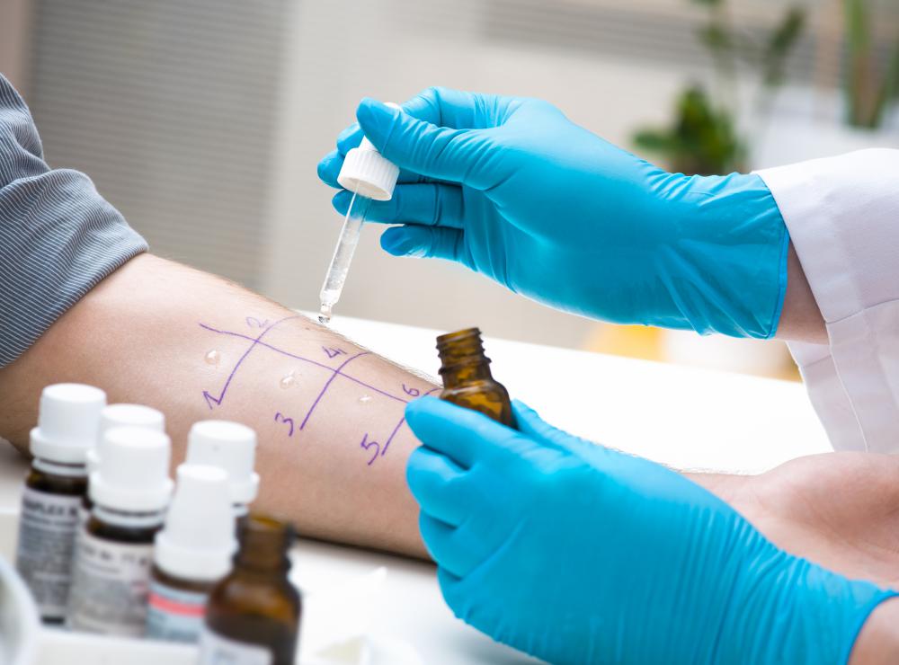 Allergy skin test to determine cause of itching.
