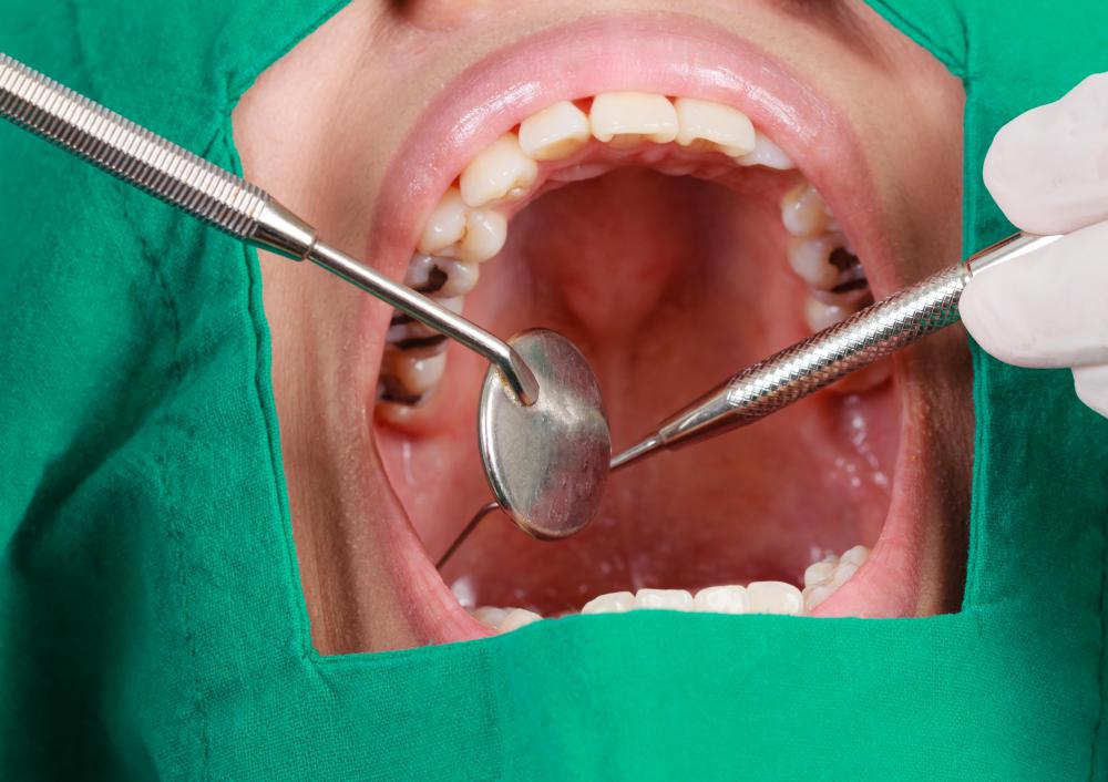 Periodontal pockets are discovered during a dentist exam.