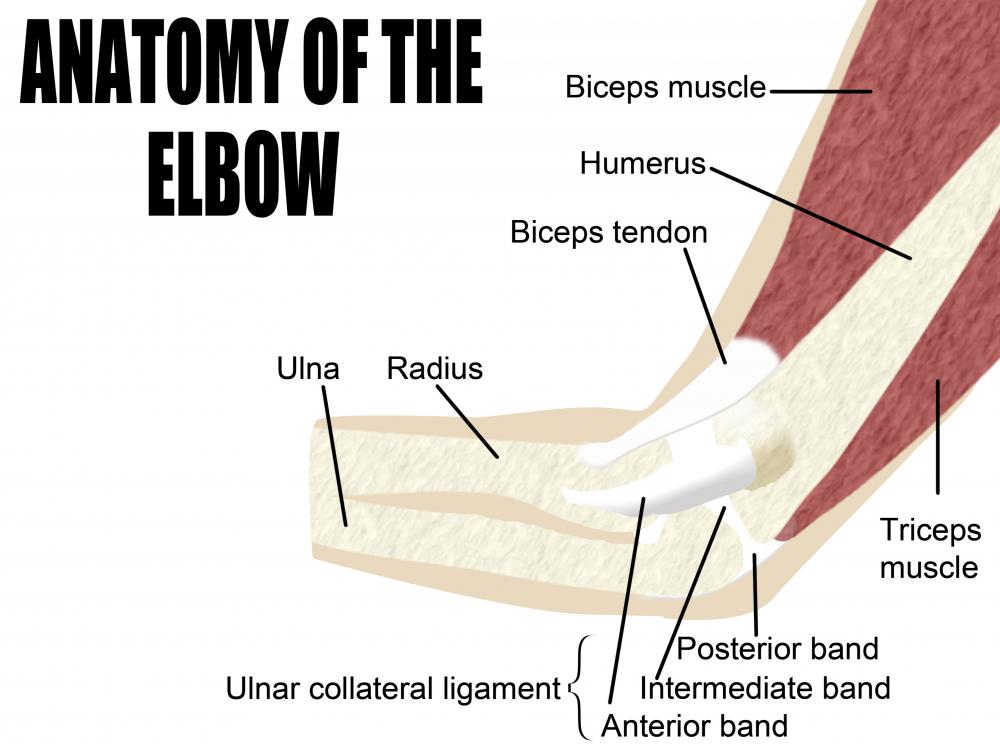 Oblique fractures frequently occur along the humerus.