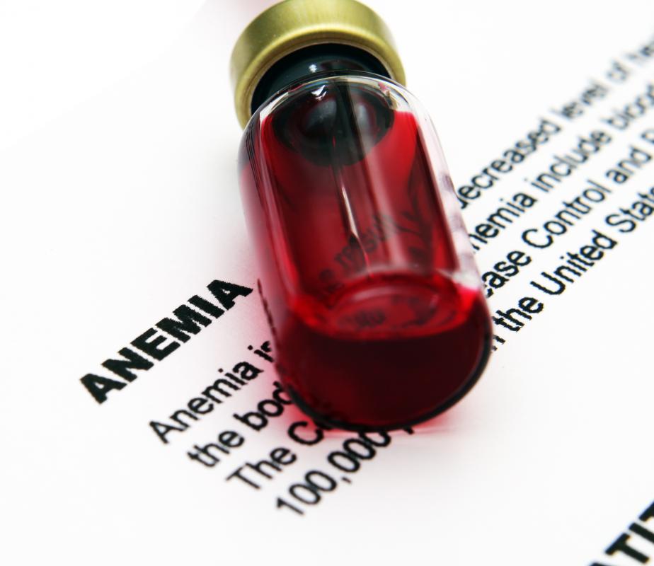 Injections of Vitamin B-12 may be necessary for some anemics.