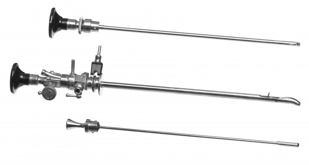 After being prepped for removal of the stent, the doctor may thread a cystoscope through the urethra until it reaches the stent.