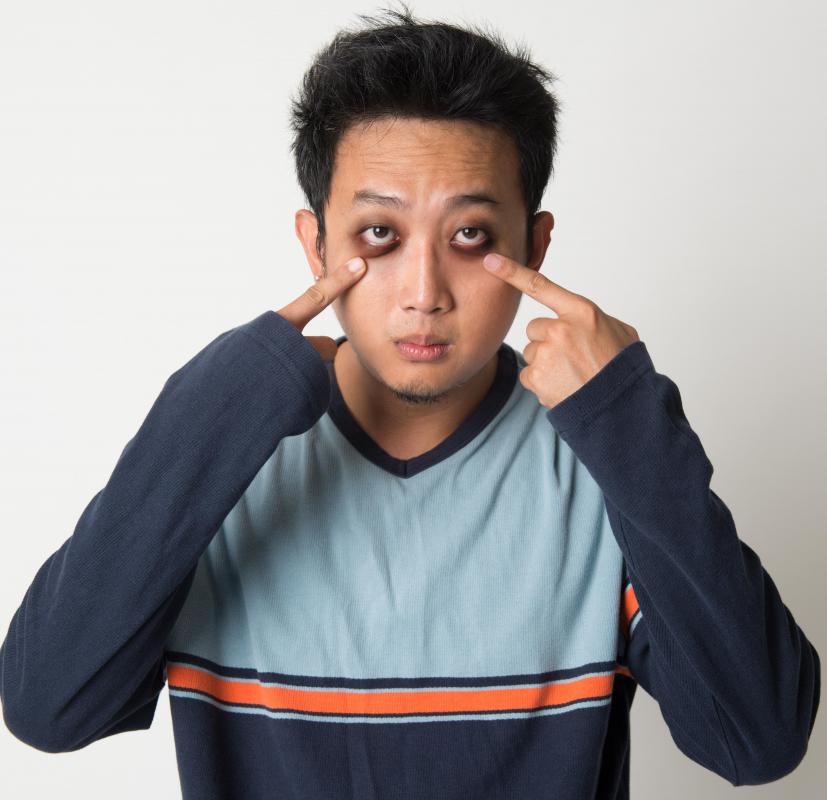 Dark circles under the eyes are common with an allergic reaction to pistachios.