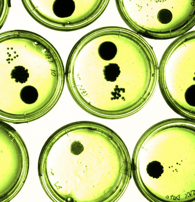 The Bacteria domain in the three-domain system contains only the kingdom of Bacteria.