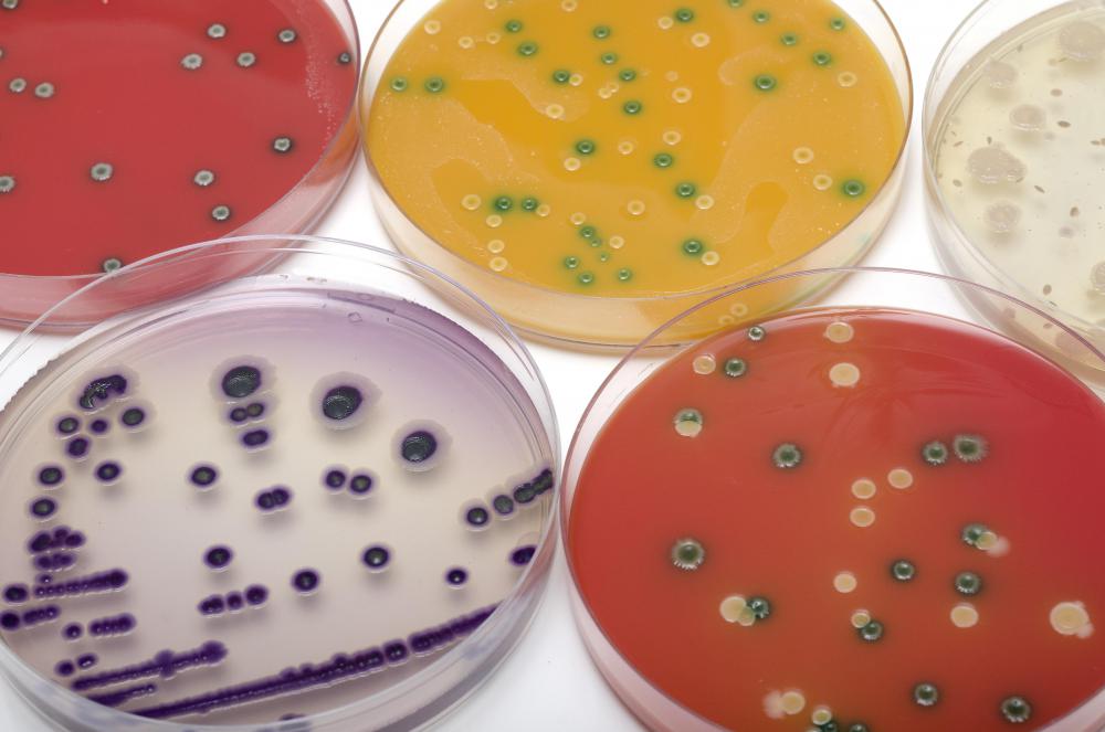 Anaerobic bacteria are bacteria that do not need oxygen to live.