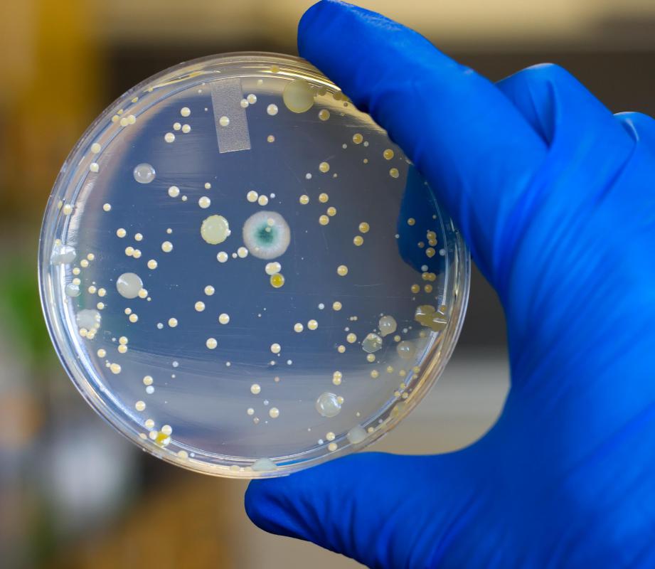 A petri dish is one of the most common ways to set up a bacterial culture.