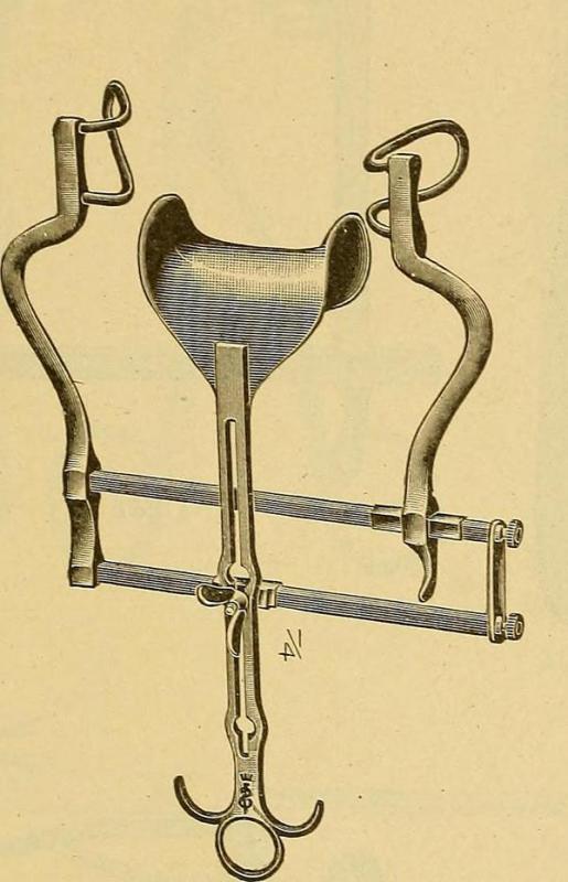 The Balfour retractor is one type of surgical retractor.