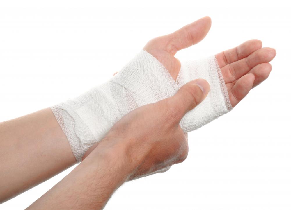 Tensor bandages are also called ace bandages or ace wraps.