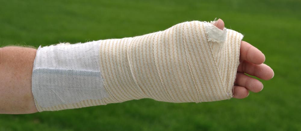 The purpose of a Robert Jones bandage is to compress and limit mobility in order to provide support, reduce bleeding, and limit swelling following surgery or trauma.