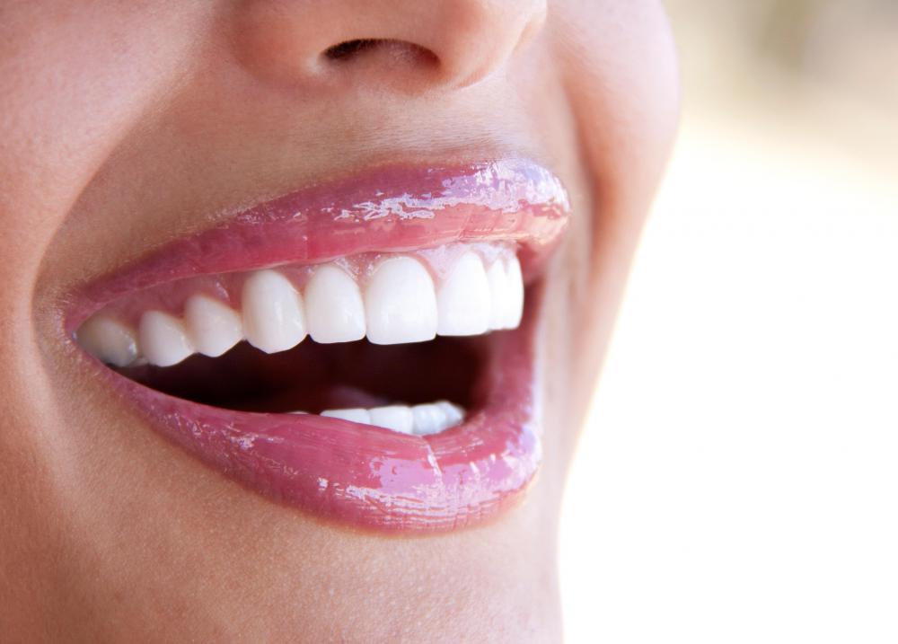 A woman with healthy gums.