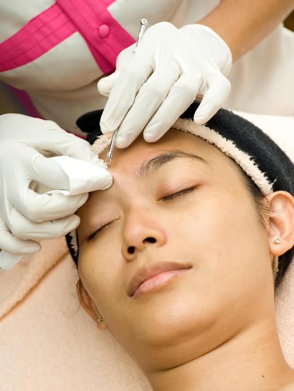 A comedone extraction is one option for dealing with acne.