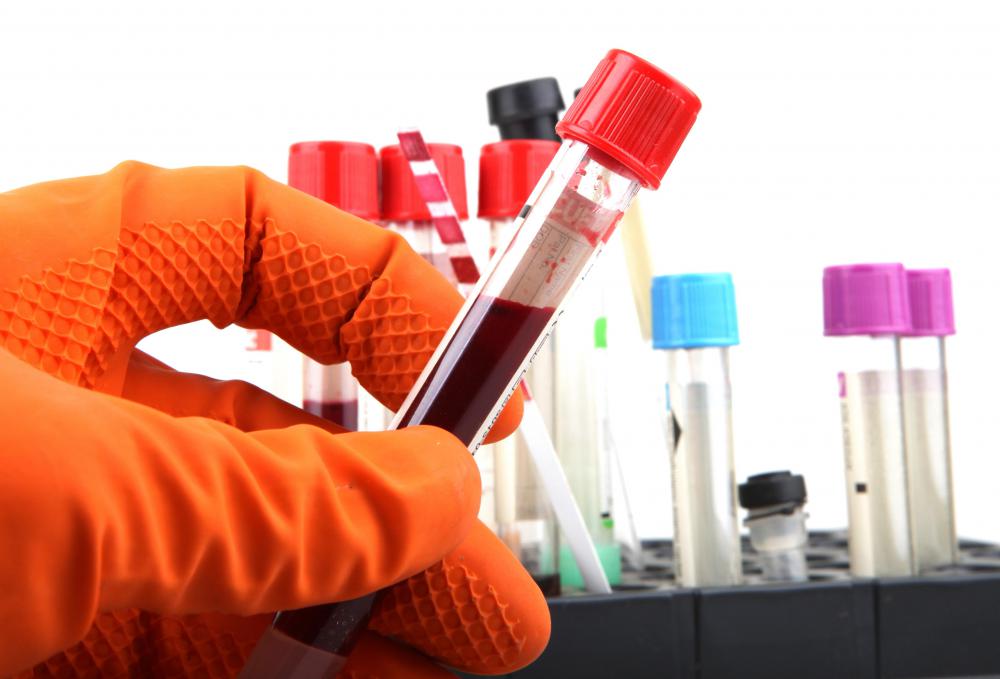 Heart conditions can be diagnosed with blood testing that measure blood enzyme levels.