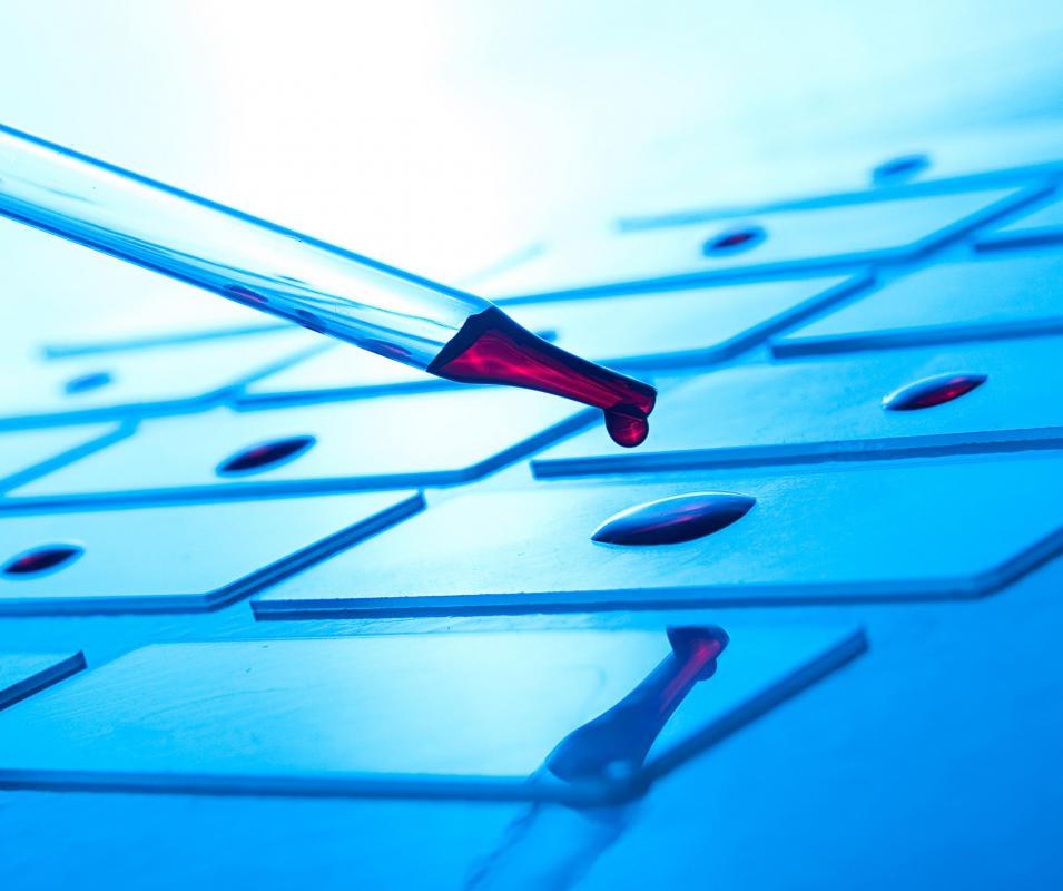 Basophilia may be diagnosed by analyzing blood samples.