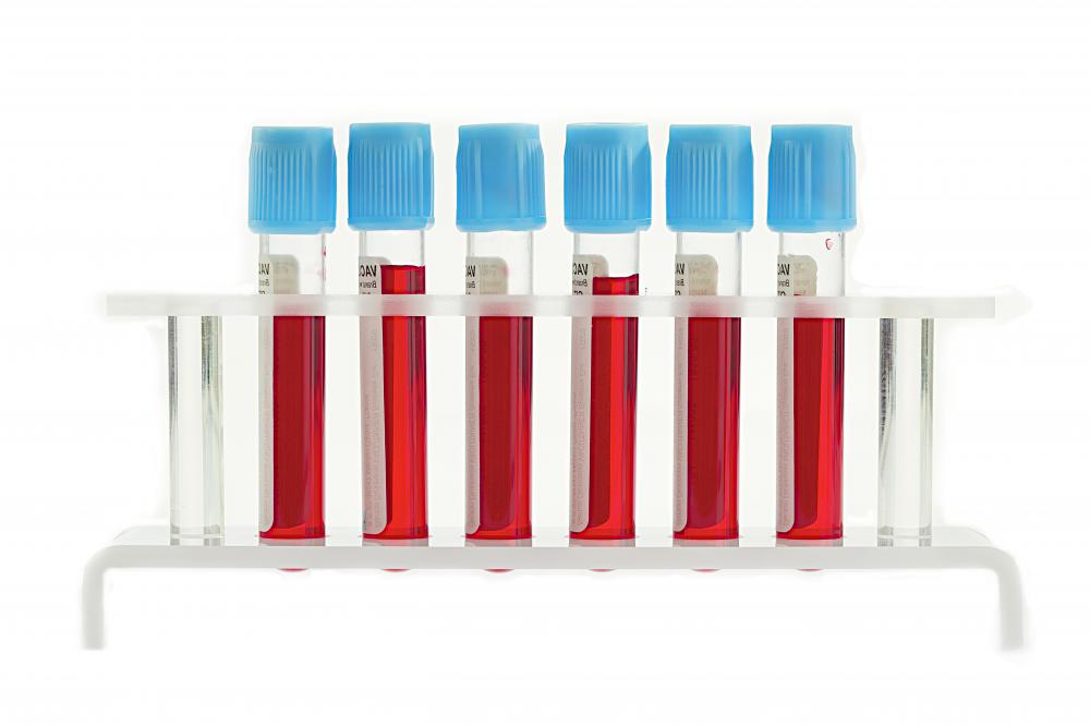 The ELISA test might require a blood sample.