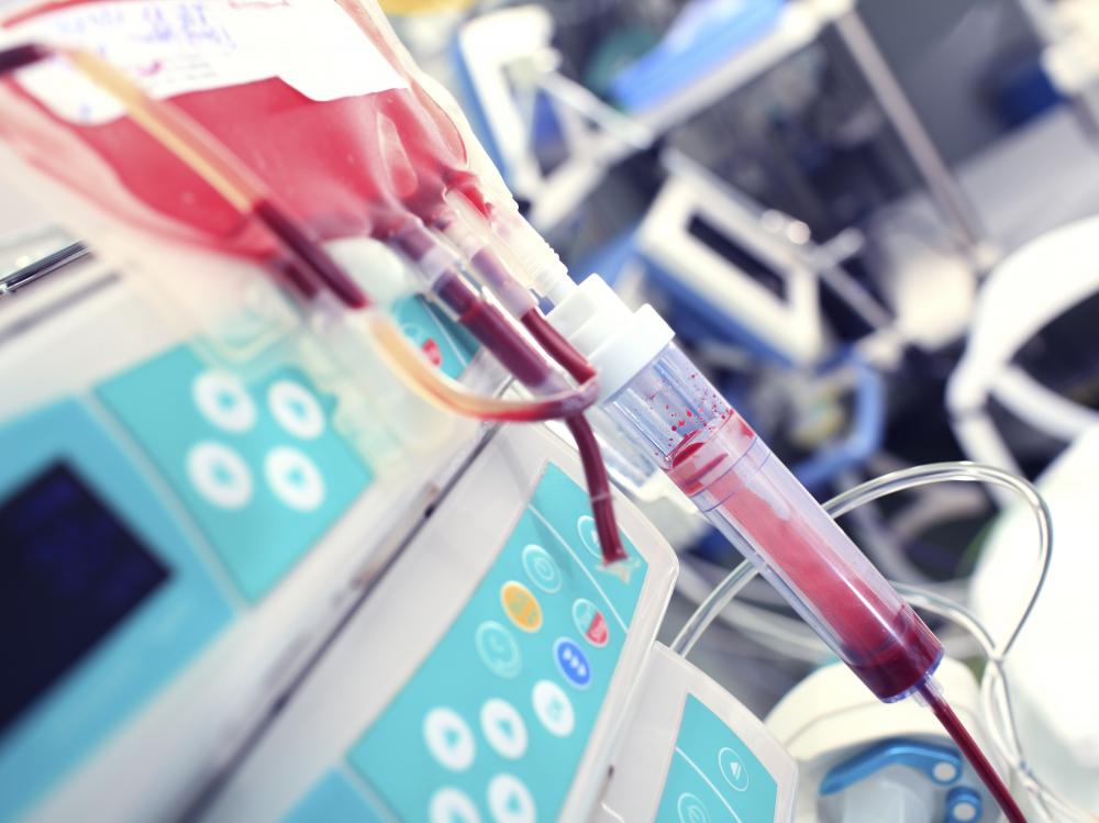 Most blood transfusions utilize a large vein in the arm.