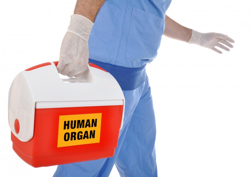 Patients must be prepped before the new organ can be transplanted.