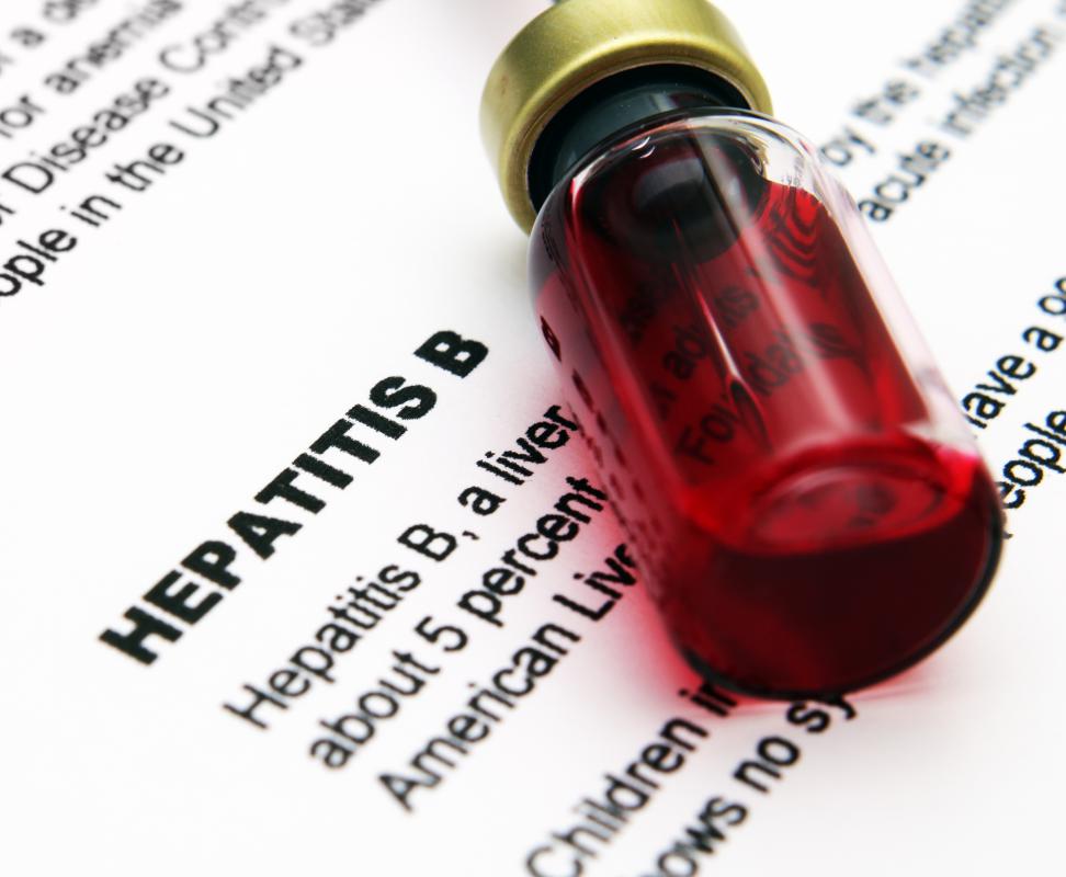 A blood test can reveal the severity of a hepatitis infection.
