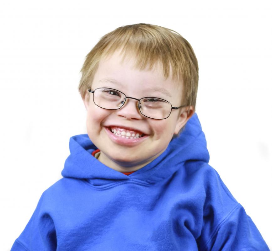 A young boy with Trisomy 21 or Down Syndrome.