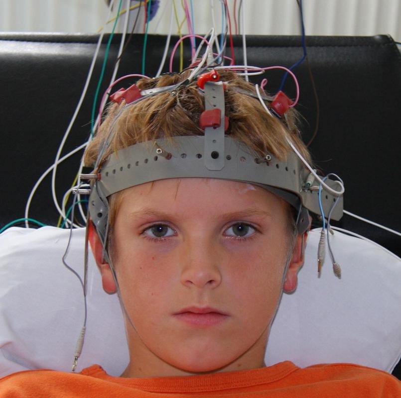 A boy connected to an EEG machine.