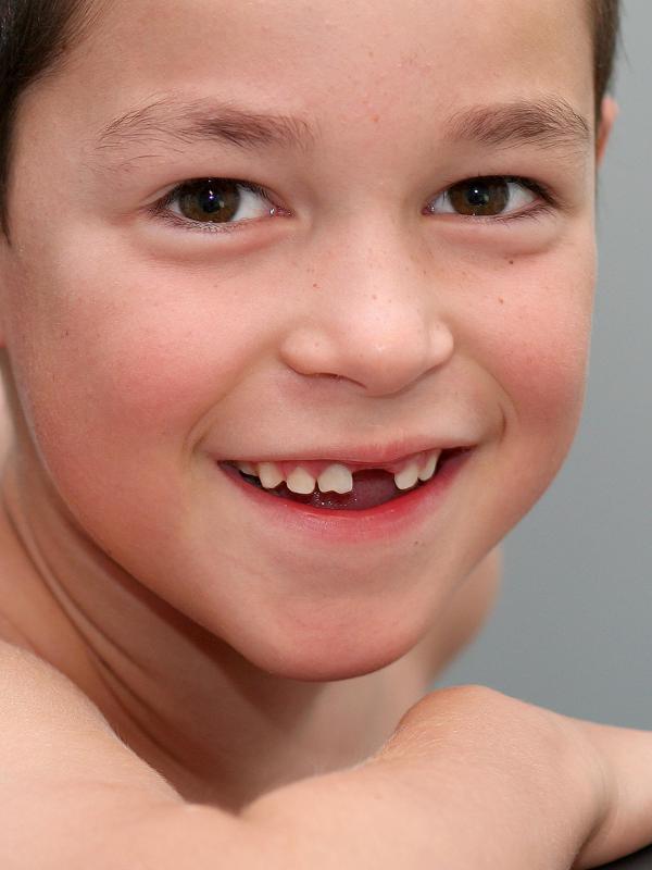 Boy with missing tooth.