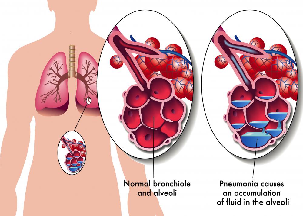 Bronchioles are located at the end of the brochi.