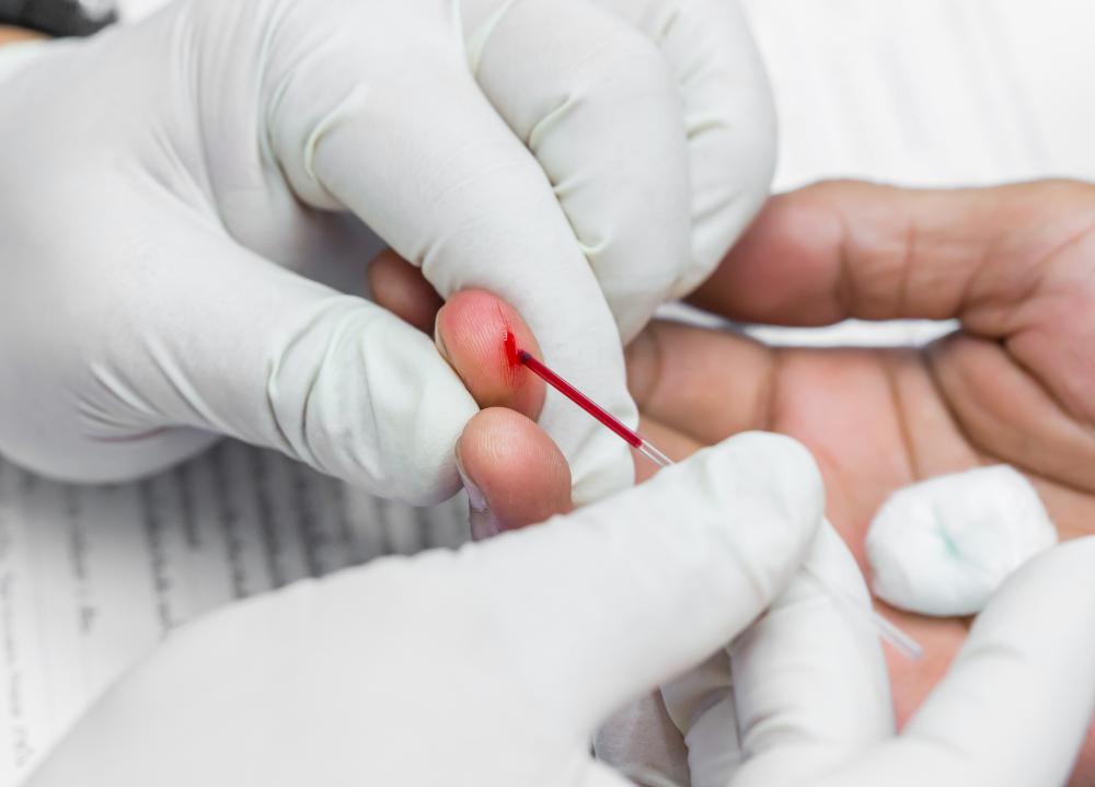 A hepatitis blood test can determine which form of hepatitis a patient has.