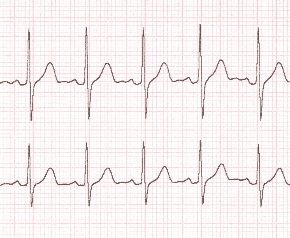 A readout of electrical activity of the heart will be provided during an EKG.