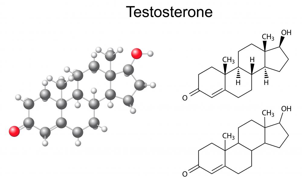 Testicular feminization results from the body’s inability to respond to androgens such as testosterone.