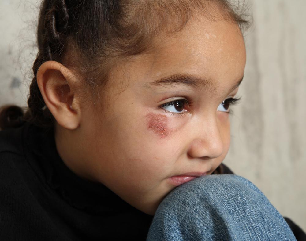 A parent may be granted full custody if the other parent is believed unfit to provide a safe home.
