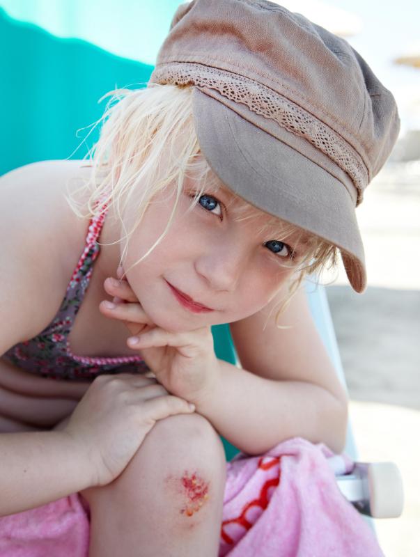 Young kids sometimes scrape their knees when playing on a seesaw or other playground equipment.
