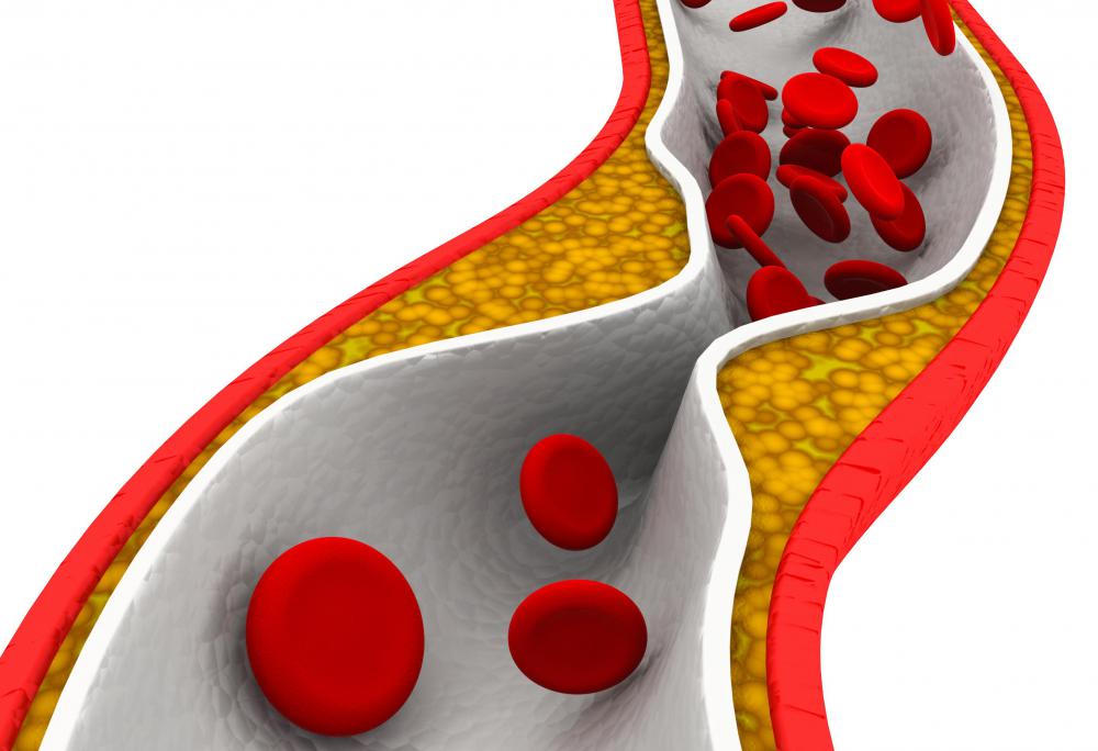 Cholesterol helps stabilize phospholipid bilayer, but too much cholesterol can be dangerous for arteries involved in blood flow.