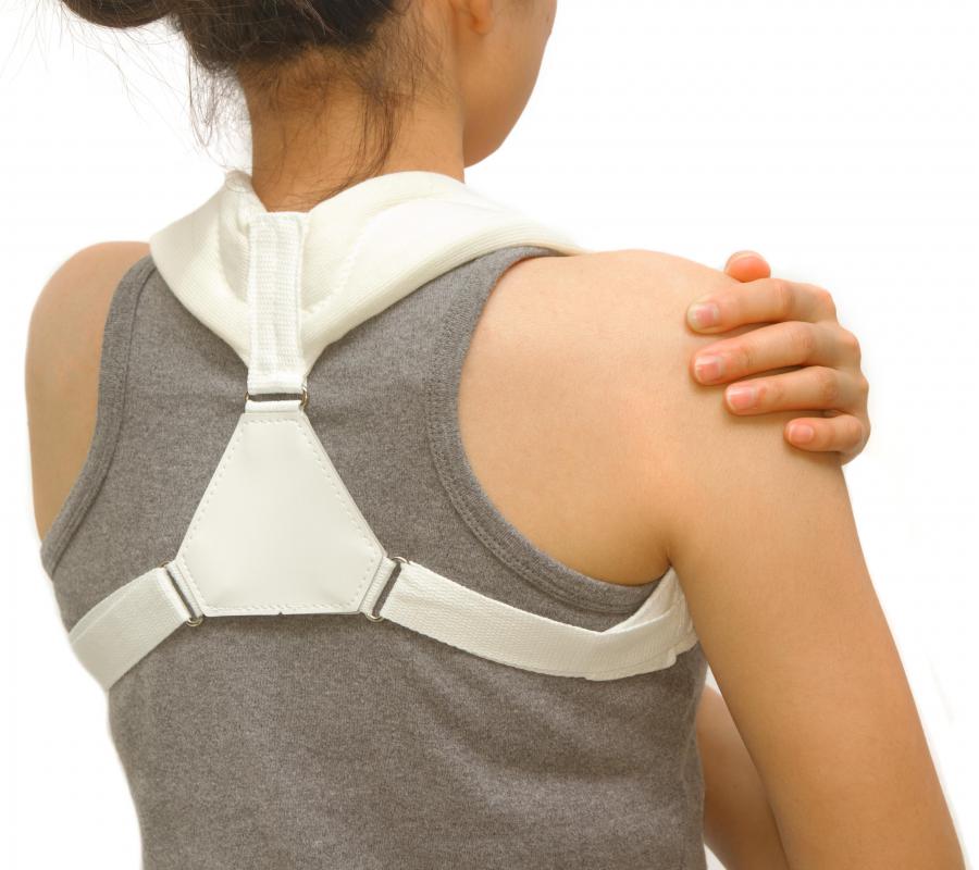 An injury to a gliding joint like the clavicle may require wearing a brace.