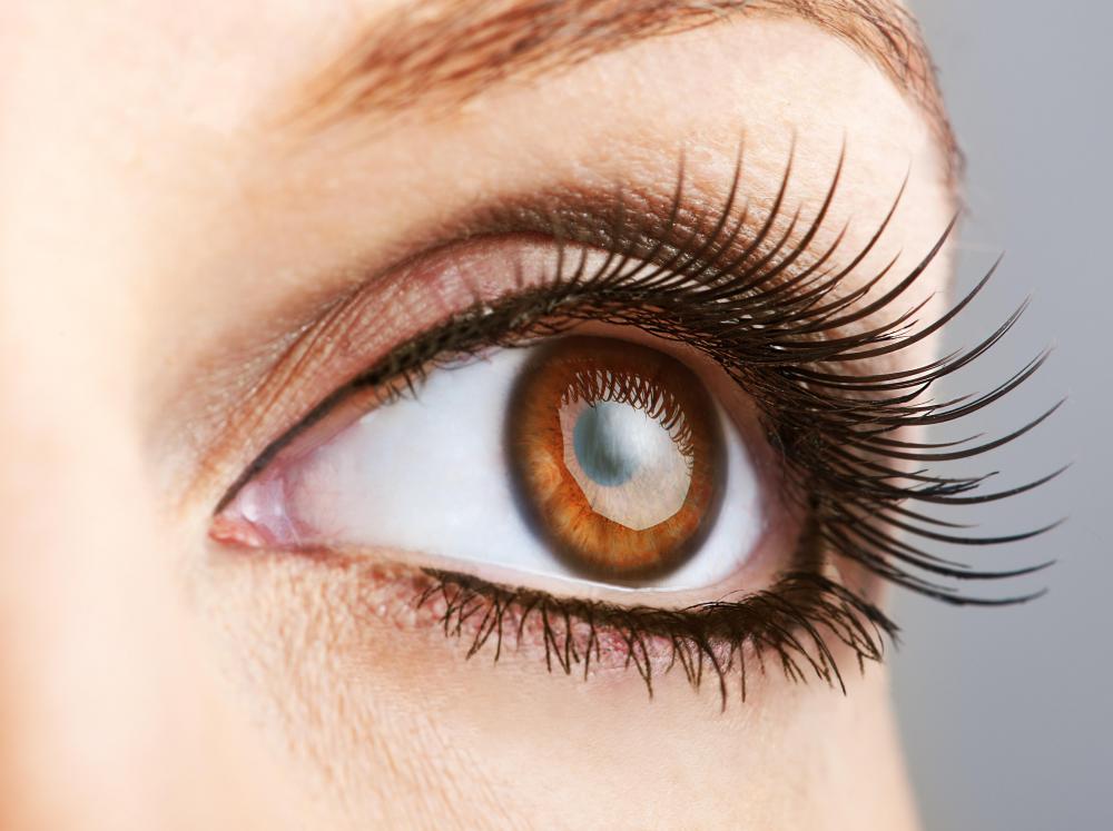 If the iris is brown, a person is said to have brown eyes.