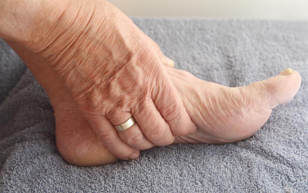 Sitting all day without moving may cause swelling in the feet and legs.