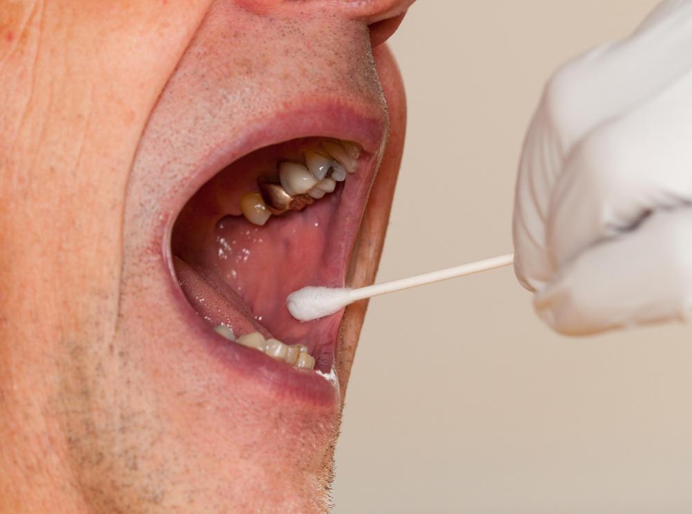Swab cultures can be used to identify DNA.