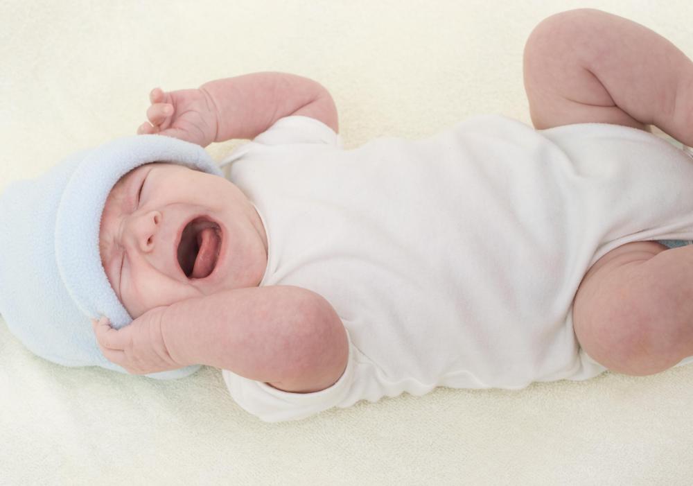 Meatal stenosis most commonly occurs in babies whose penises are irritated from urine in their diapers.
