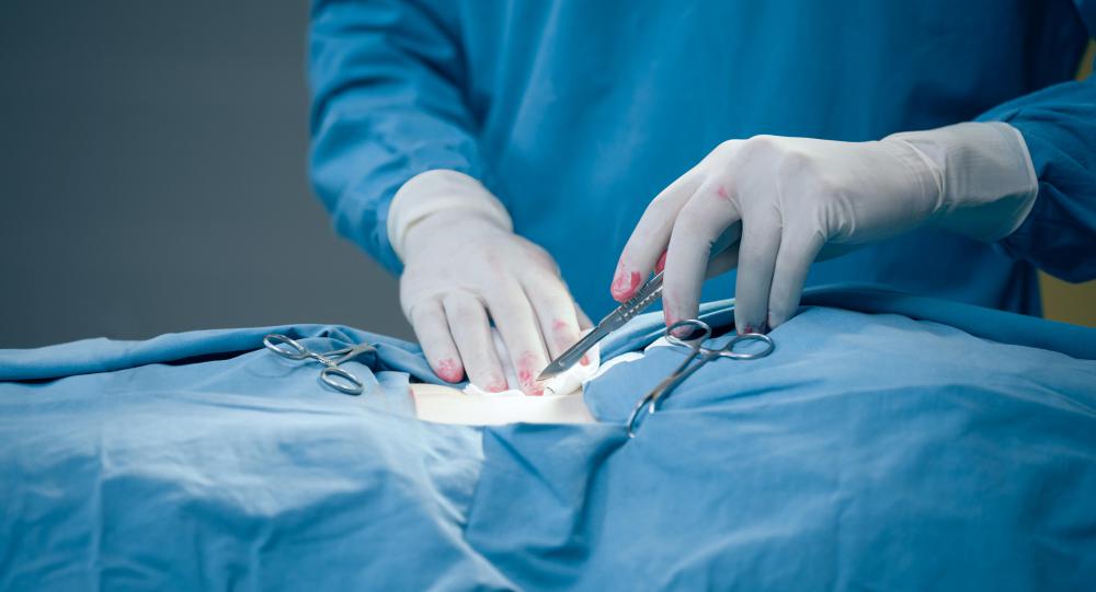 There are always micro-organism present within a surgical incision, but they don't always cause an infection.