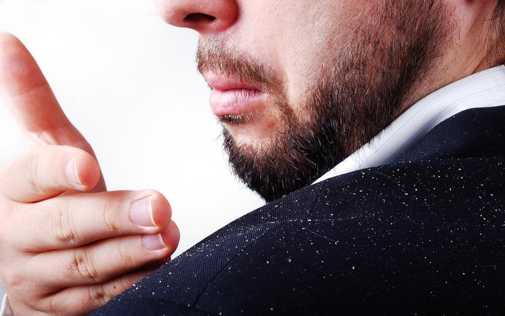 Dandruff is a type of dermatitis.