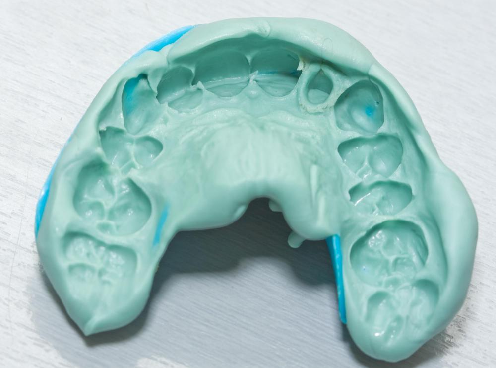 Dental impressions may be taken of the teeth for aid in the treatment of dental conditions.