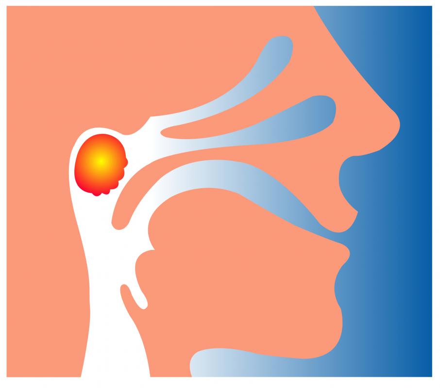 A human head with the adenoids in red and yellow.
