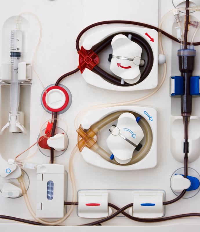 A hemodialysis machine.