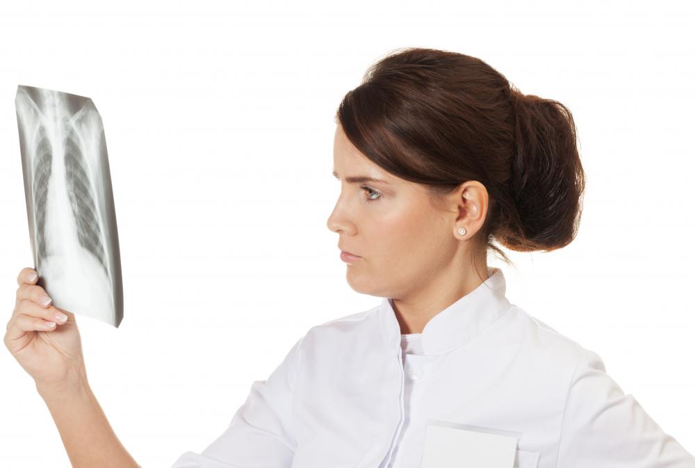 Doctor looking at chest radiograph.