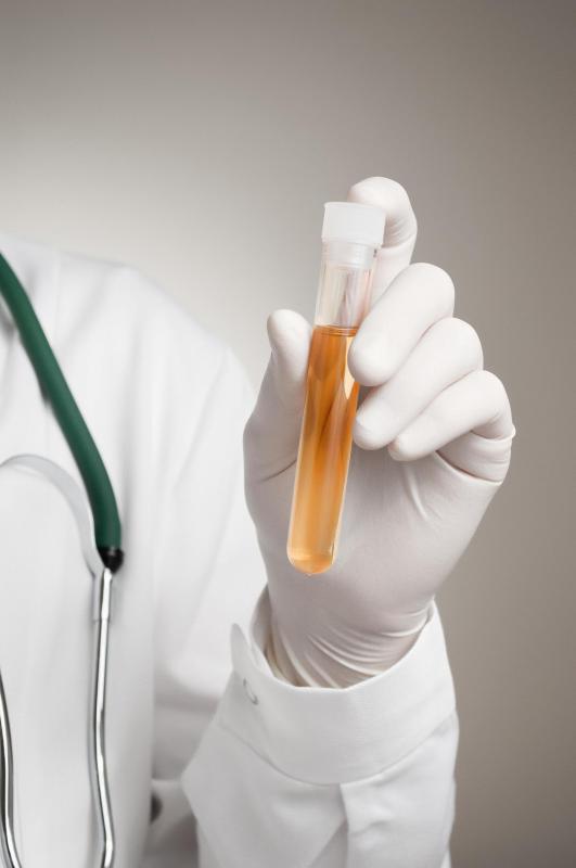 Urine is a waste fluid.