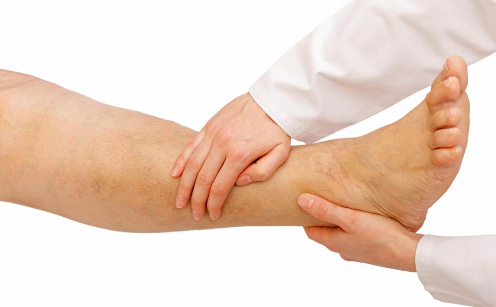 Edema in the ankles, legs, and feet may be a manifestation of right ventricular hypertrophy.