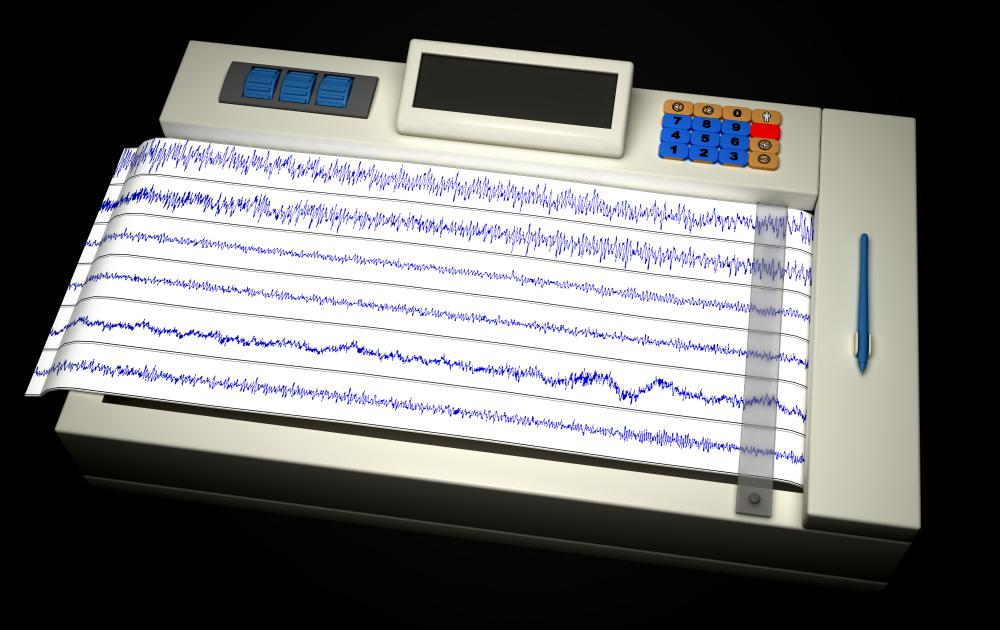 A type of neurofeedback equipment, an electroencephalogram -- or EEG -- machine measures electrical impulse activity in the brain and can help give a diagnosis for conditions such as seizures.