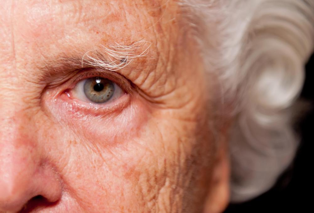 Wellness salons offer a suite of anti-aging treatments including chemical peels and microdermabrasion techniques that remove topical, dead layers of the skin.