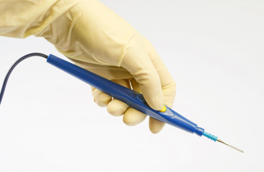 Treatment of polyps may involve cauterization.