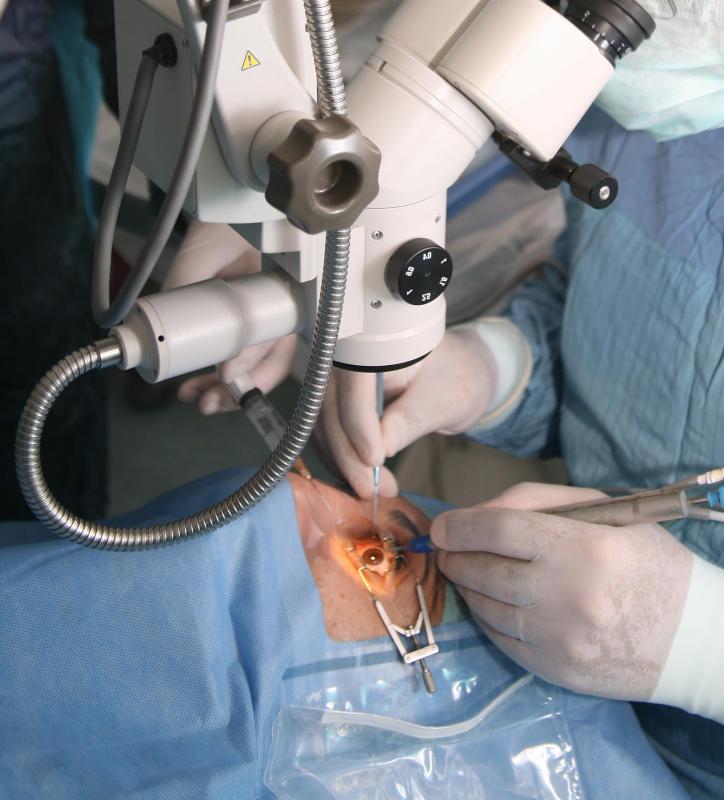 The cornea is cut and reshaped during keratomileusis.