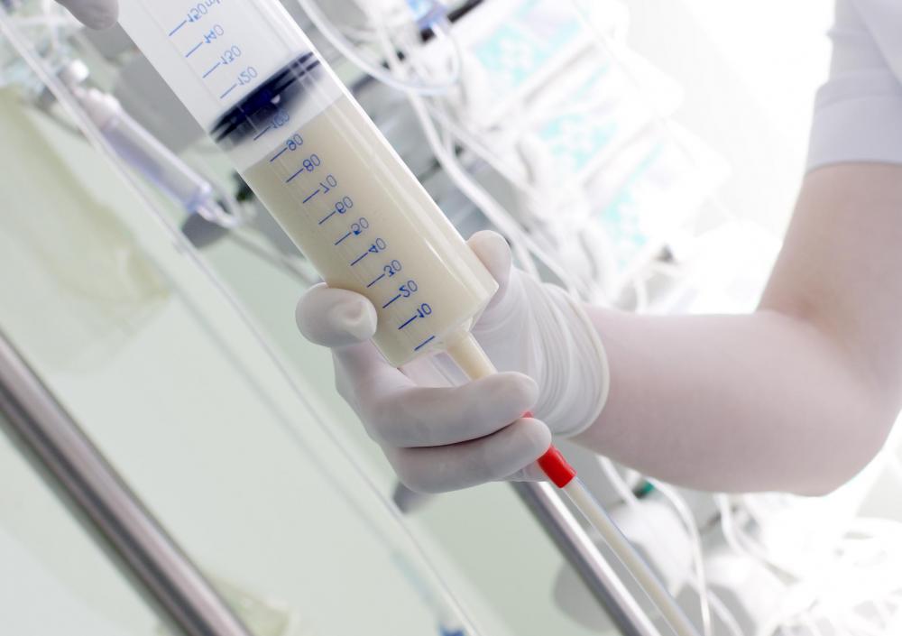 A jejunostomy is a surgical procedure in which a hole is made in the small intestine to insert a feeding tube.